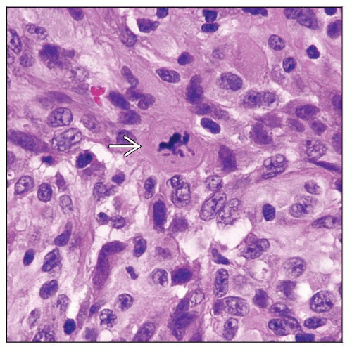 Interdigitating Dendritic Cell Basicmedical Key