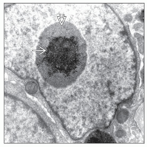 Lead and Other Heavy Metal Toxins Basicmedical Key