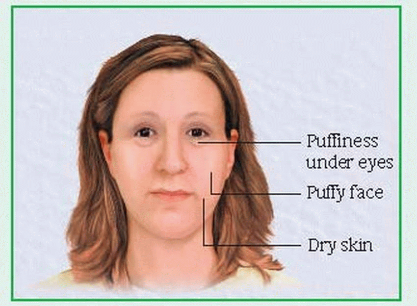 Endocrine Disorders Basicmedical Key