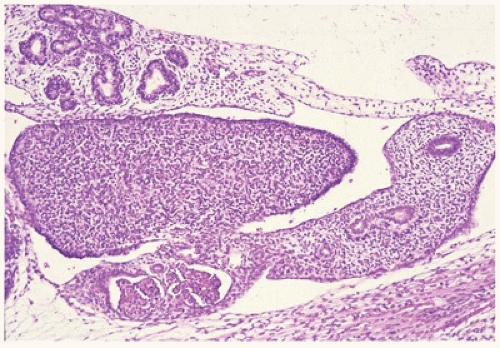 The Female Reproductive System Basicmedical Key