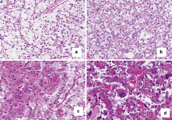 Classification of Adult Renal Tumors and Grading of Renal Cell