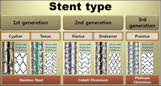 Stents: Functions, Characteristics, And Materials | Basicmedical Key