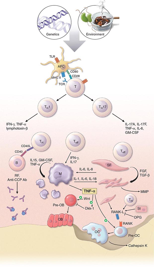 Acute Rheumatic Fever Basicmedical Key