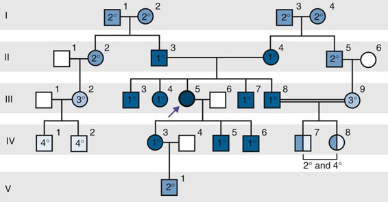 Pedigrees | Basicmedical Key