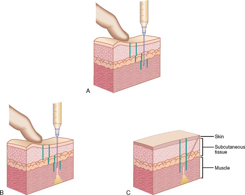 9. INJECTABLE PREPARATIONS WITH CLINICAL APPLICATIONS Basicmedical Key