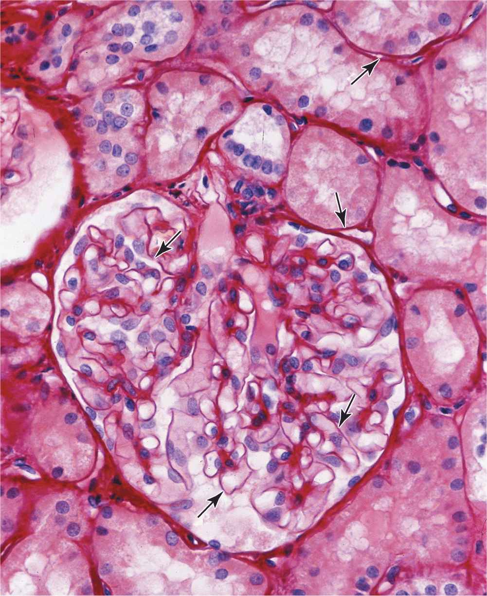 Basement Membrane Connects Epithelial Tissue To The Best Picture