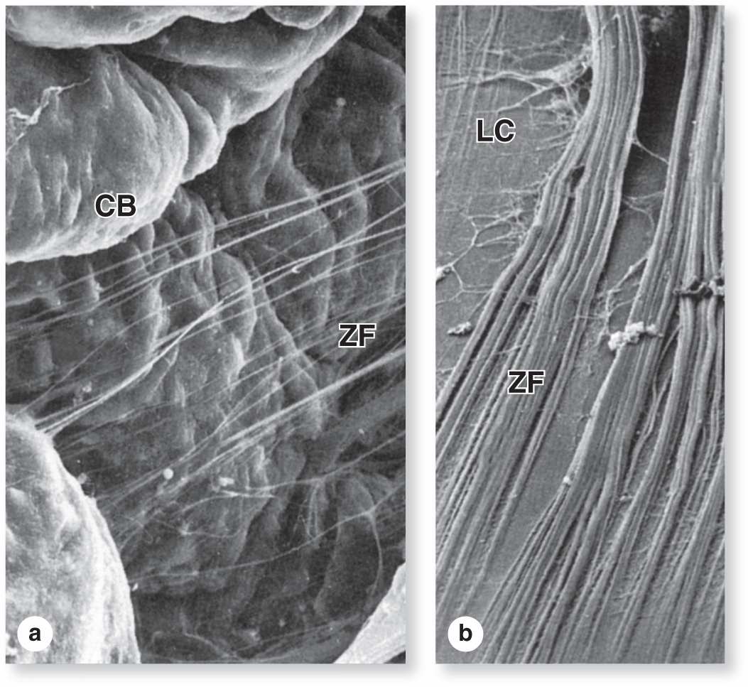 The Eye & Ear Special Sense Organs Basicmedical Key