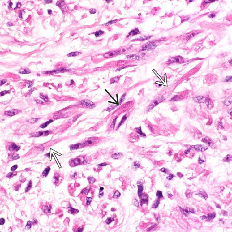 Embryonal Basicmedical Key