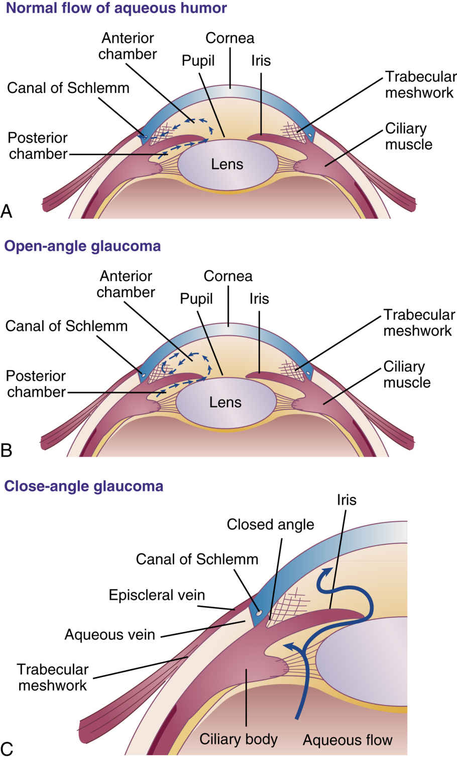Aqueous Fluid Is Drained Through The Canal Of Schlemm Best Drain