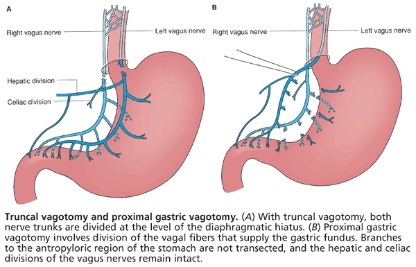 This Stomach Fact Could Change How You Treat Sprains Forever - zq5i0qe