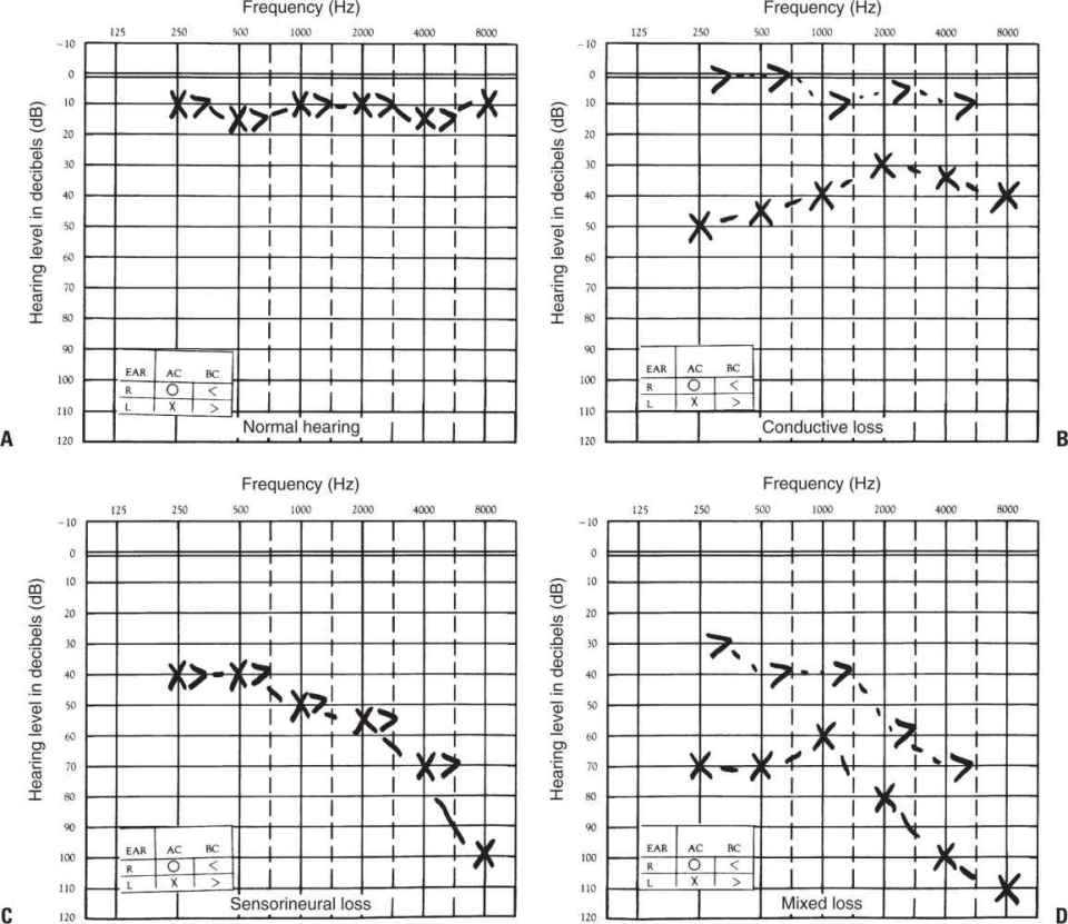 Otolaryngology Diseases Of The Head And Neck Basicmedical Key