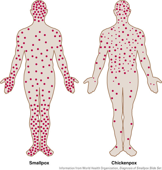 Poxviruses | Basicmedical Key
