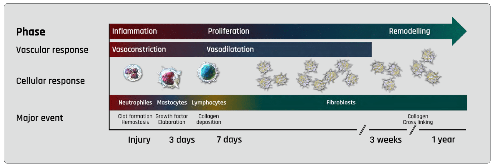 Phases of burn wound healing Basics of Burn Care