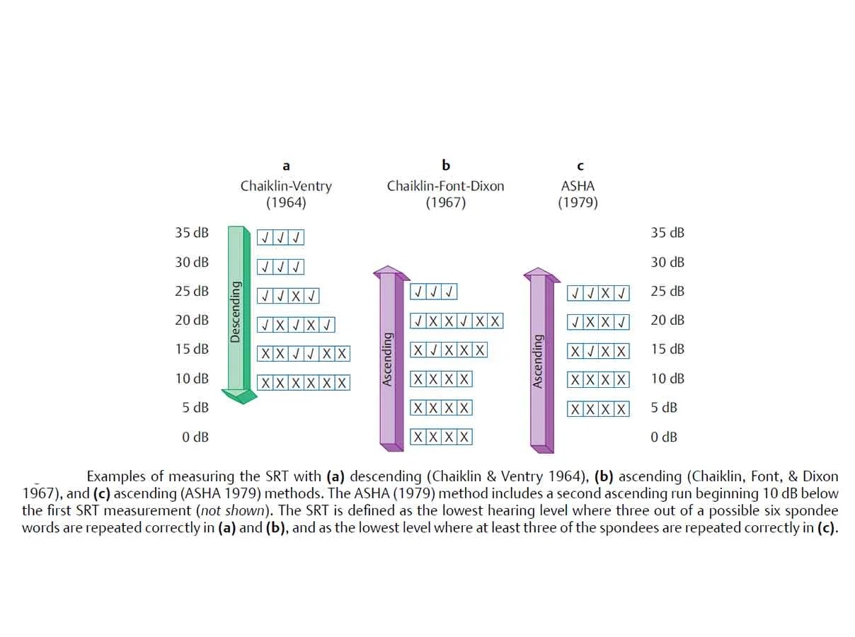 Speech Reception Thresholds Procedure and Application