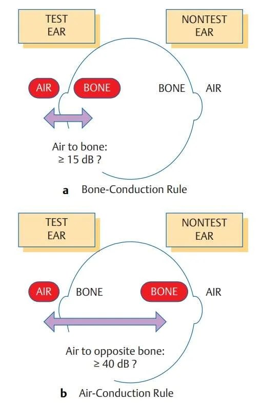 What is Clinical Masking In Hearing Tests?