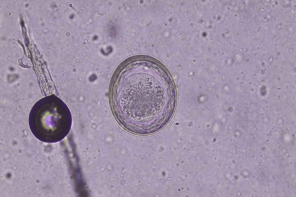 Key Considerations for Worm Infestation in Dogs Understanding the