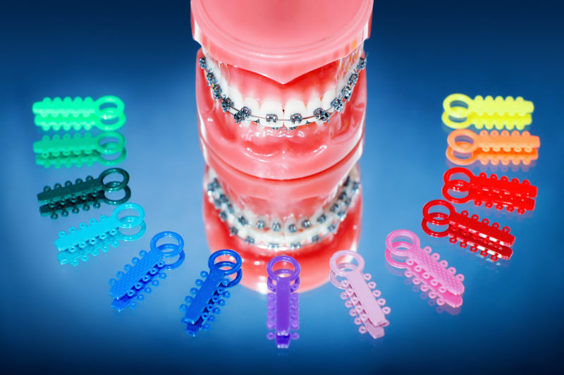 How Do Braces Fix Your Teeth? Baum Orthodontics