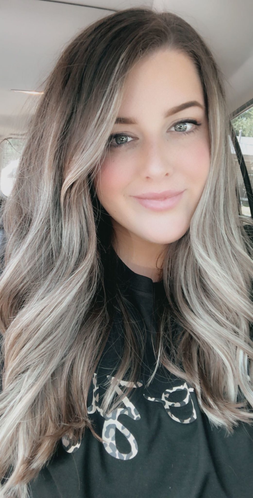 Shelby Got Bladder Cancer at 21 Years of Age Bladder Cancer Advocacy