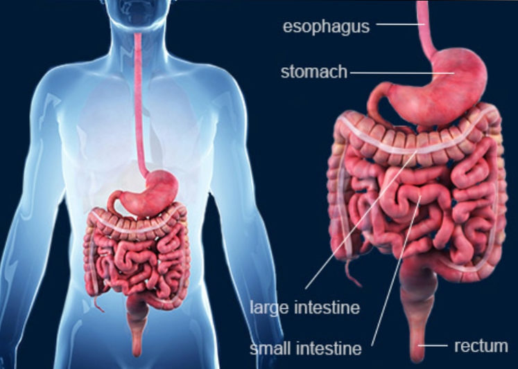 What is Crohn's Disease?