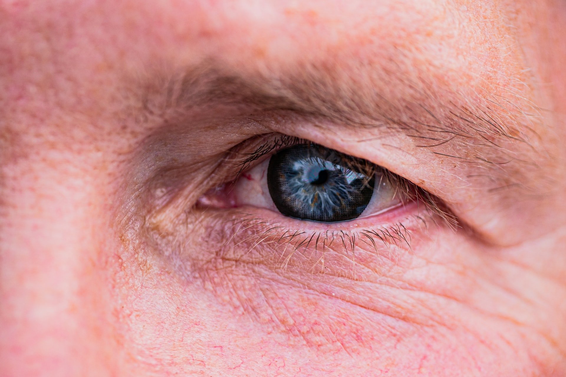 Keep Your Eyes Burn Free with Prescription Sunglasses