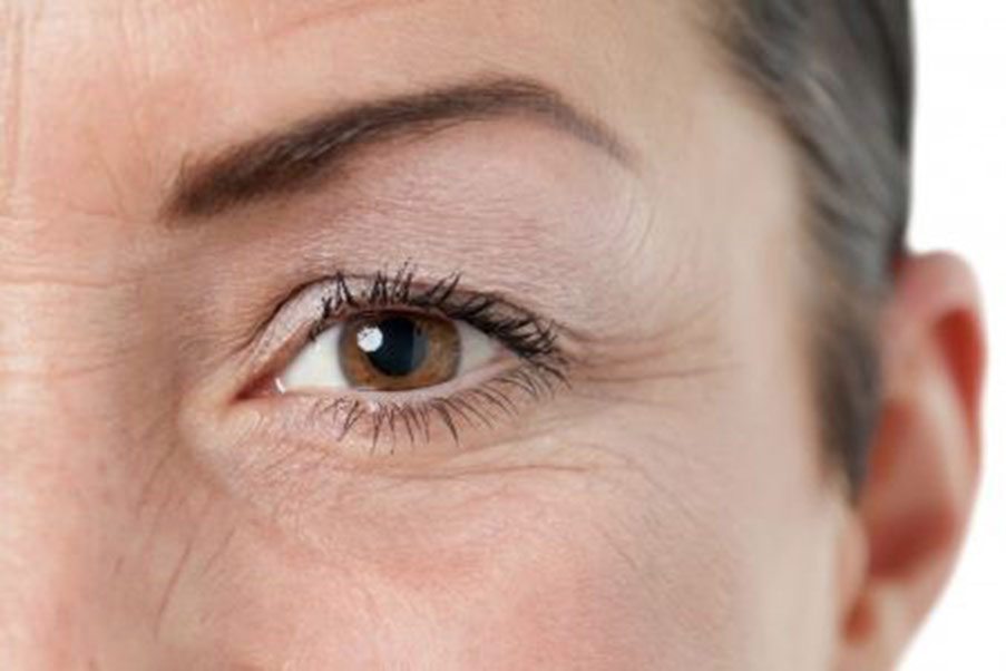 Ptosis Treatment Orange County, CA Drooping Upper Eyelid
