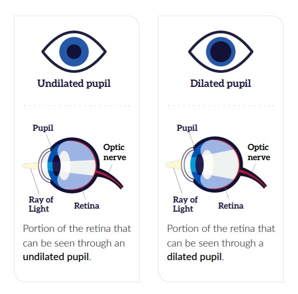 Comprehensive dilated eye exams