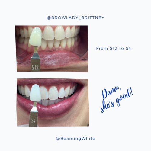 How to Whiten Teeth FAST (in 2022) Beaming White Teeth Whitening