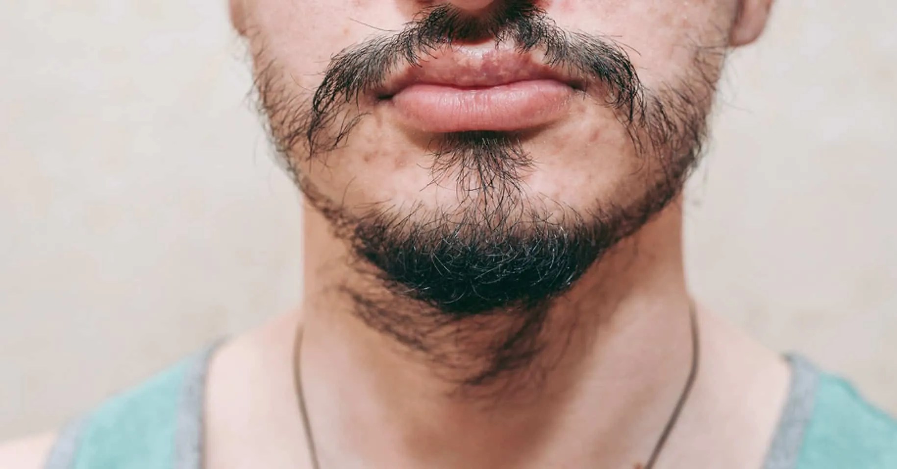 Why Is My Beard Not Connecting?