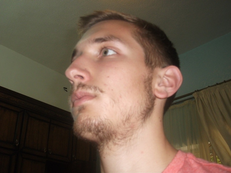 5 Reasons Your Beard Suddenly Stopped Growing