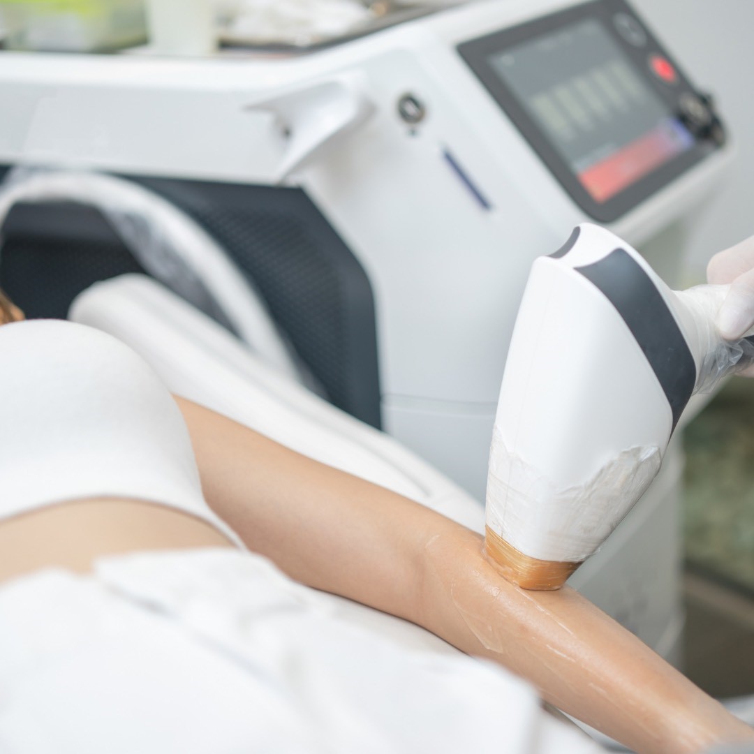 Elma Beganović Diodni laser, koji se koristi za uklanjanje dlaka u