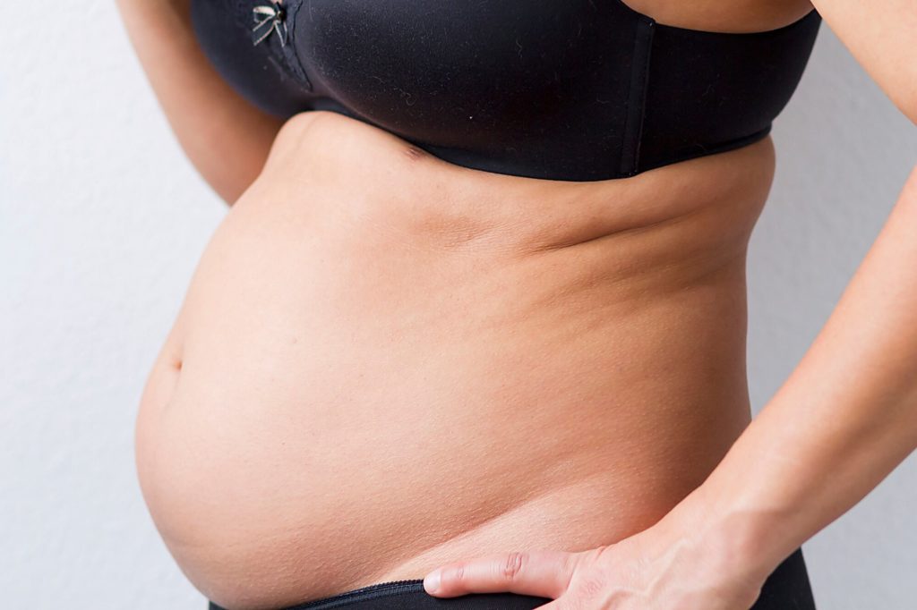 Here Are Some Ways You Can Get Rid of Your Bloated Stomach ASAP