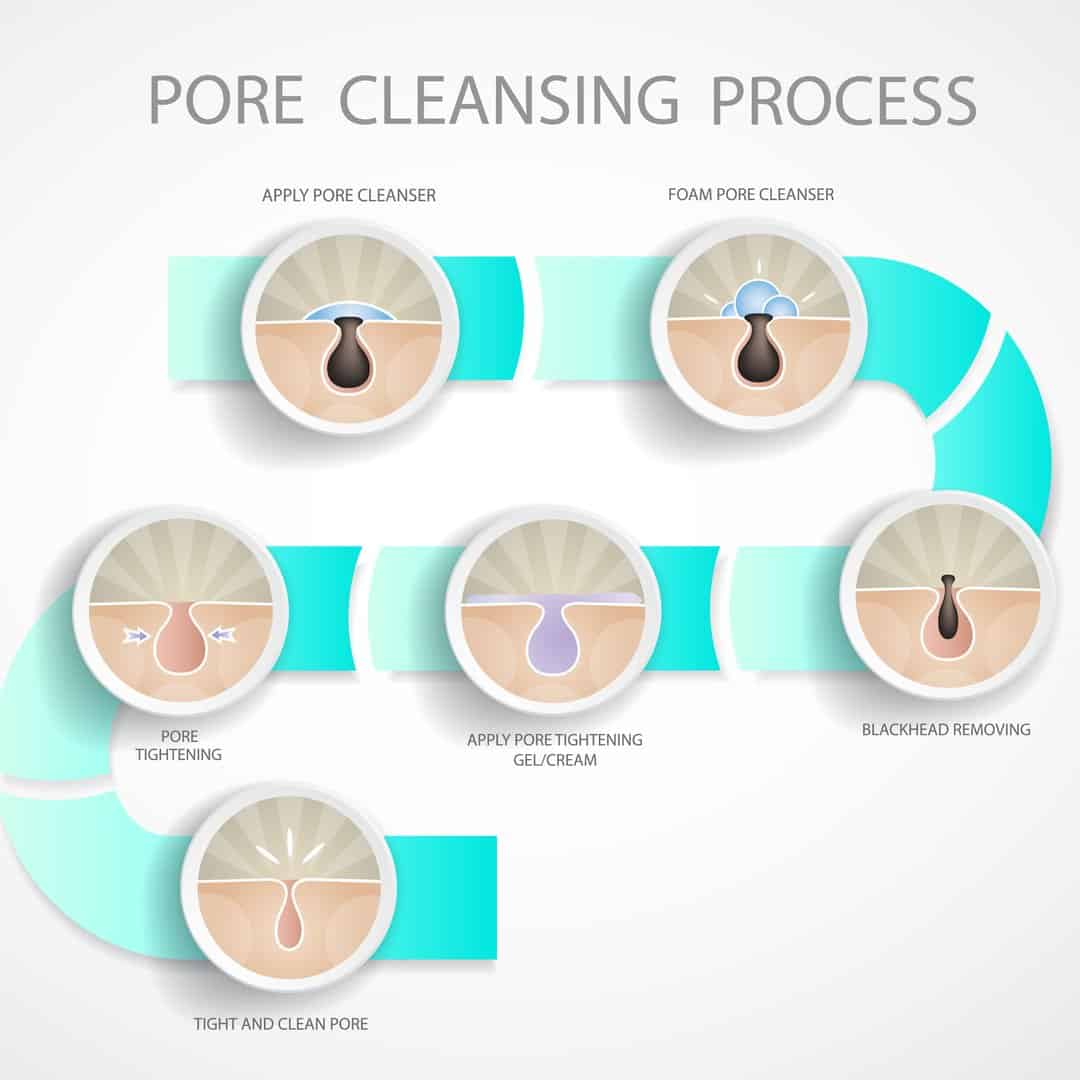 The 11 Best Blackhead Removers to Buy in 2025 Beauty Mag