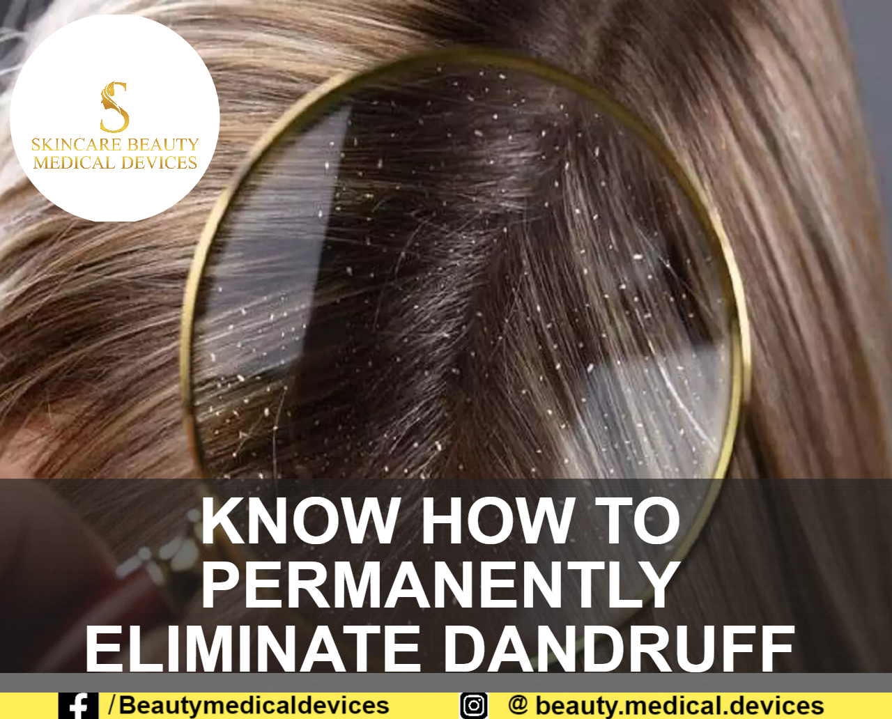 KNOW HOW TO PERMANENTLY ELIMINATE DANDRUFF