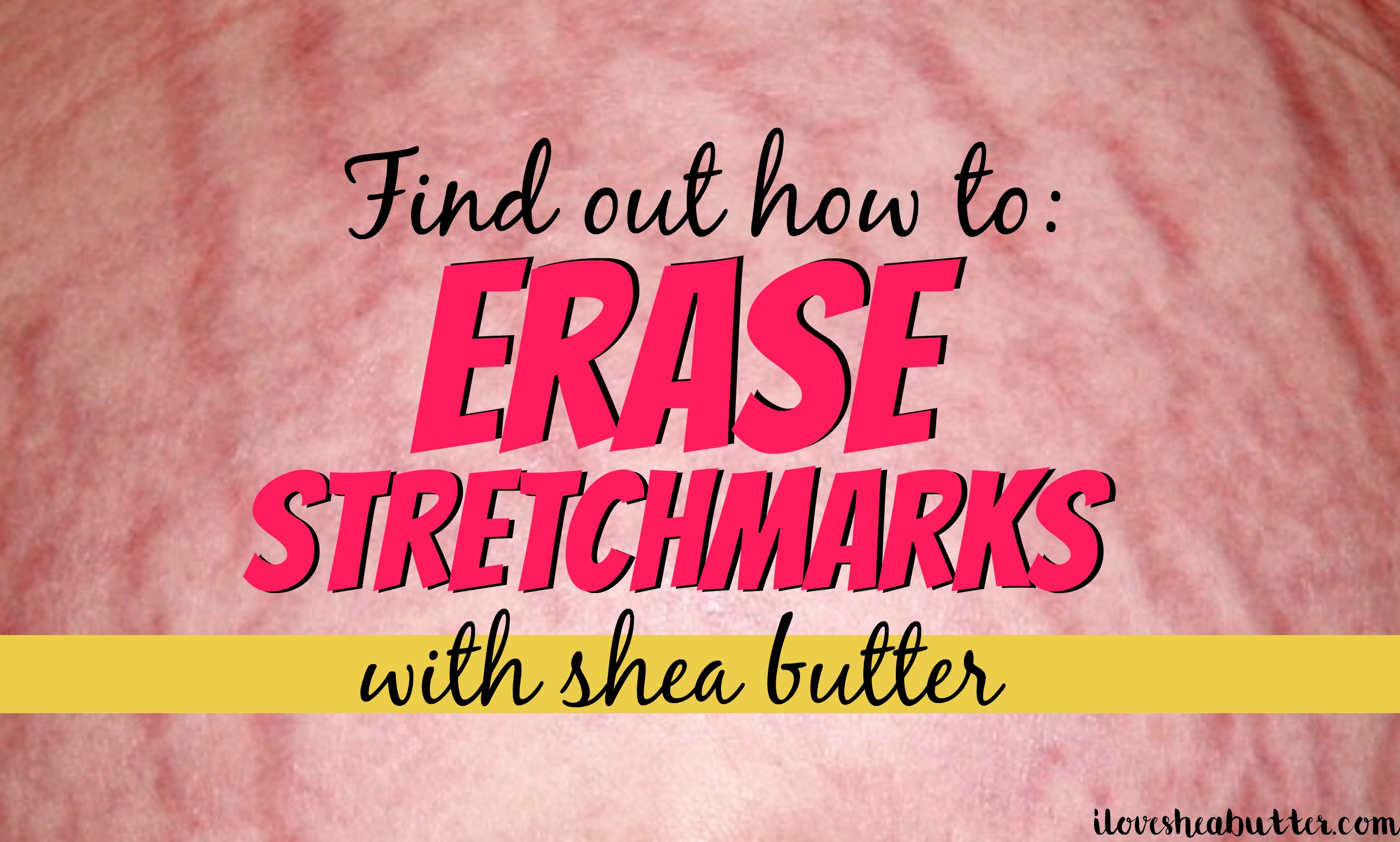 Can Shea Butter Remove Stretch Marks? beautymunsta free natural beauty hacks and more!