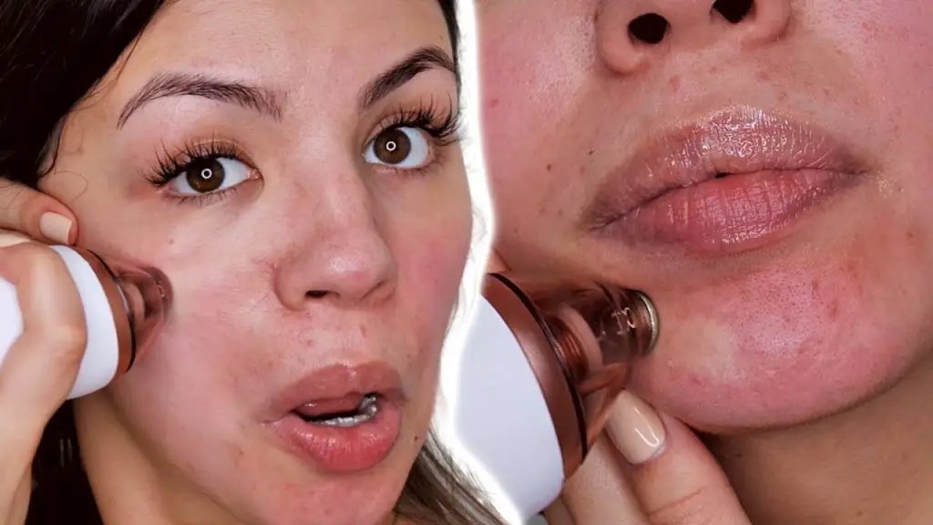 11 Best AtHome Microdermabrasion Kits and Products 2022