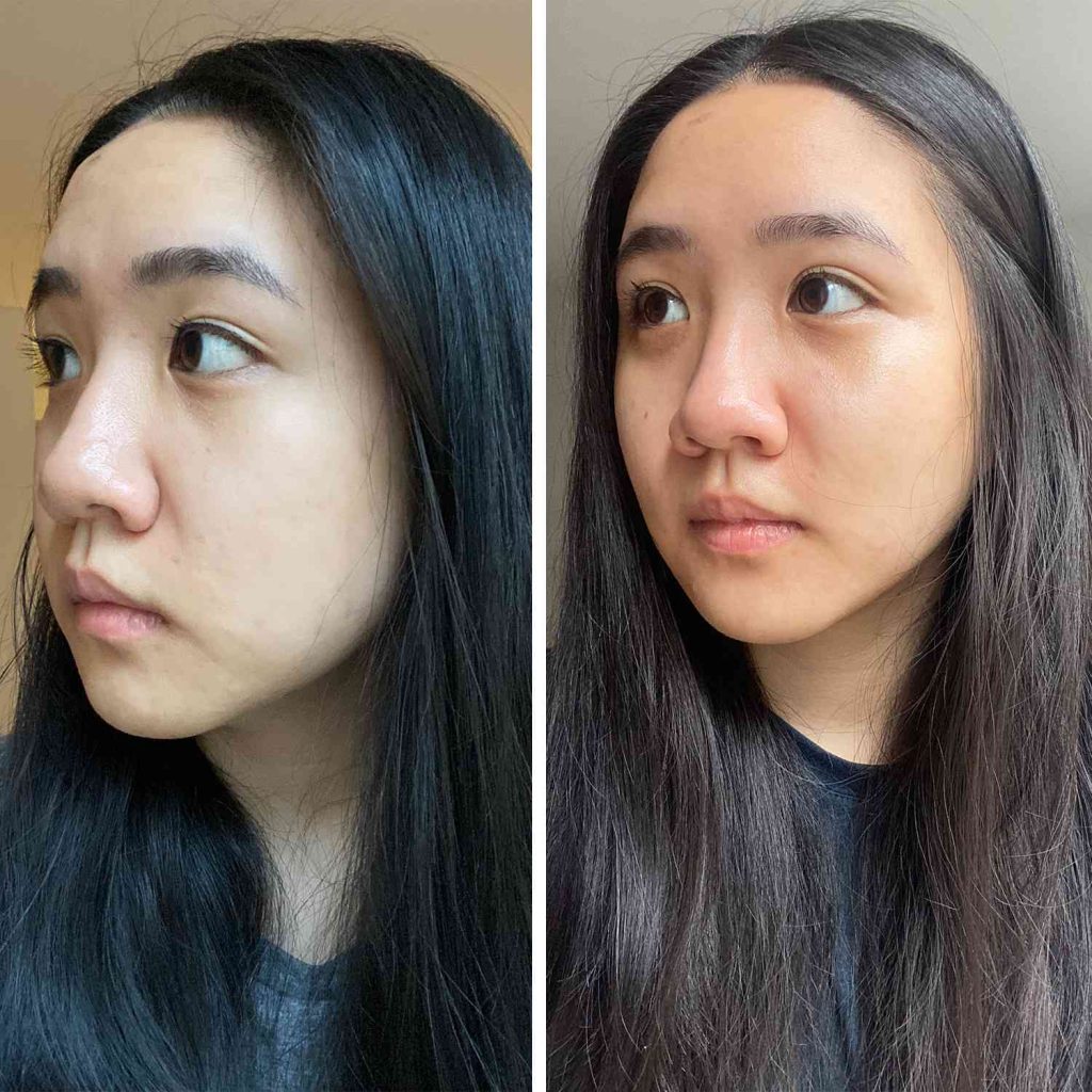 Dermapore Reviews Our Verdict On This Famous Pore Spatula