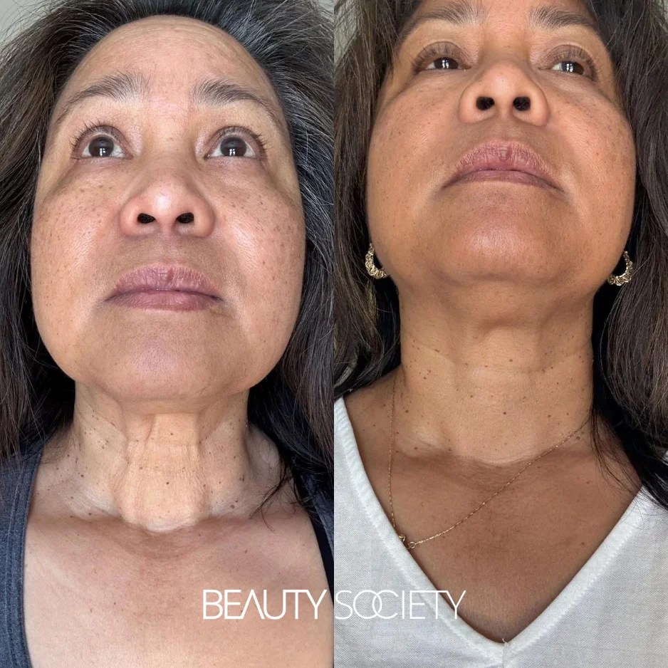 Transformations Real People, Real Results