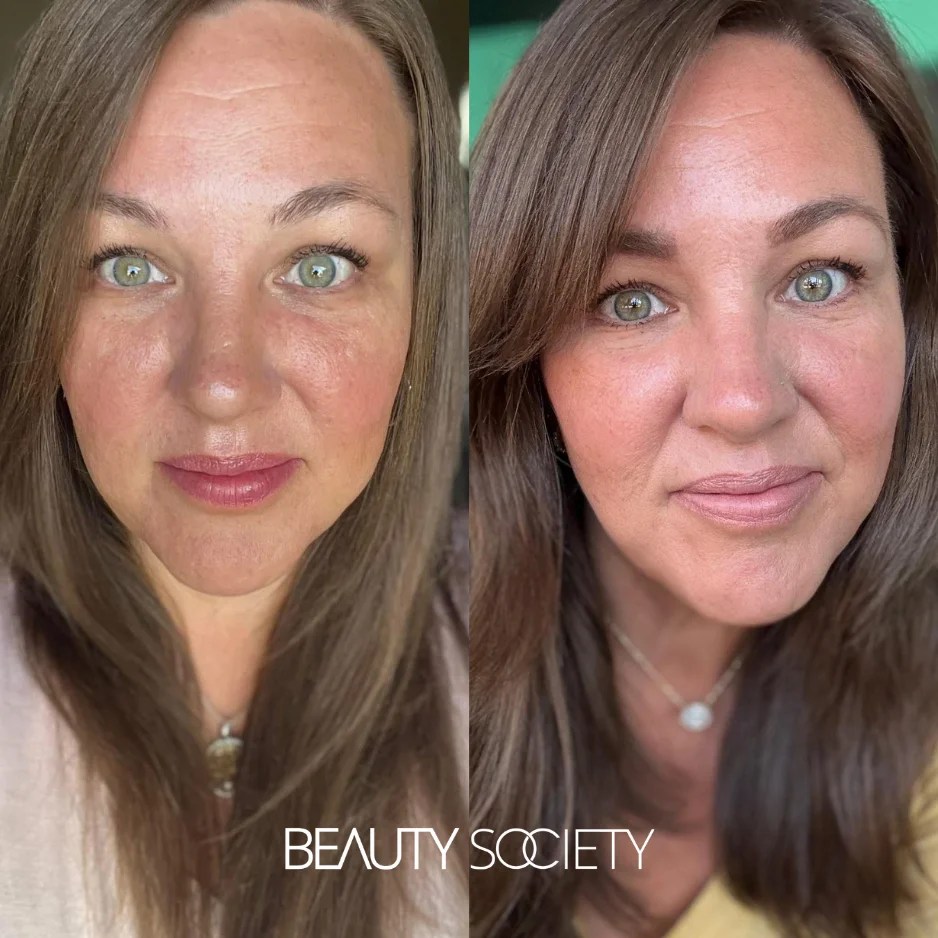 Transformations Real People, Real Results