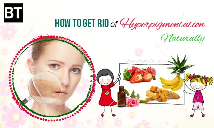34 Ways How To Get Rid Of Hyperpigmentation Naturally