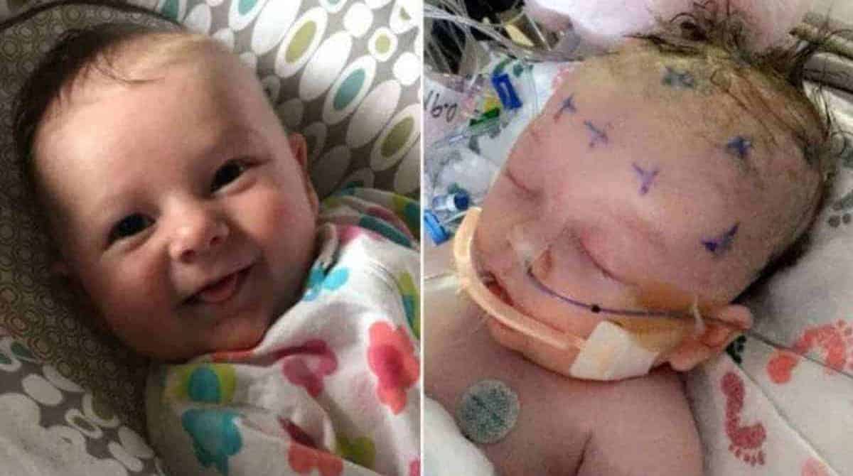 Bebê de um mês luta pela vida após ser atingida na cabeça