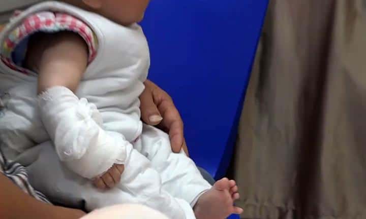 Bebê quase perde dedão de jeito chocante e que pode ocorrer com