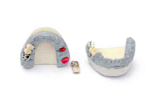 How Much Does It Cost To Replace A Tooth? (Replacement Options)