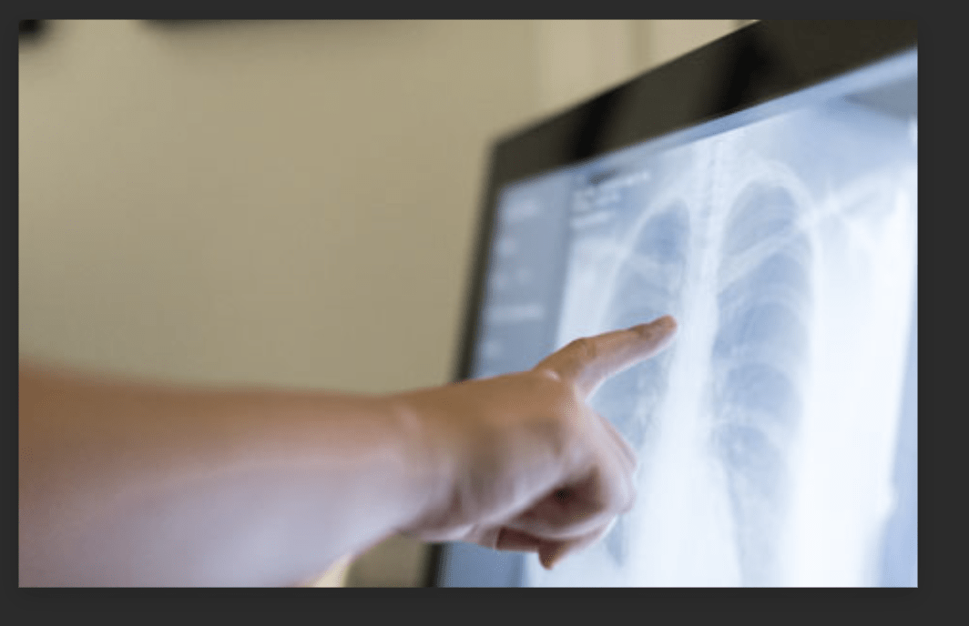 Career Opportunities Bedside XRay Service