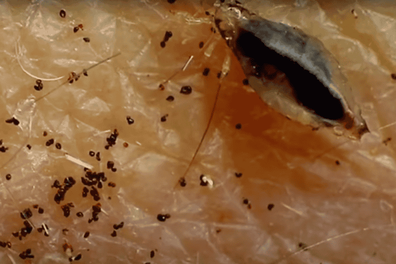 Does Hair Dye Kill Lice? Nits And Eggs Detailed Guide Beezzly