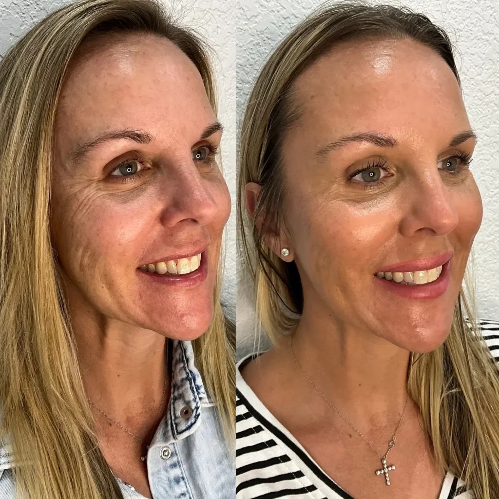 Skinvive Before and After Before After Journey(03)