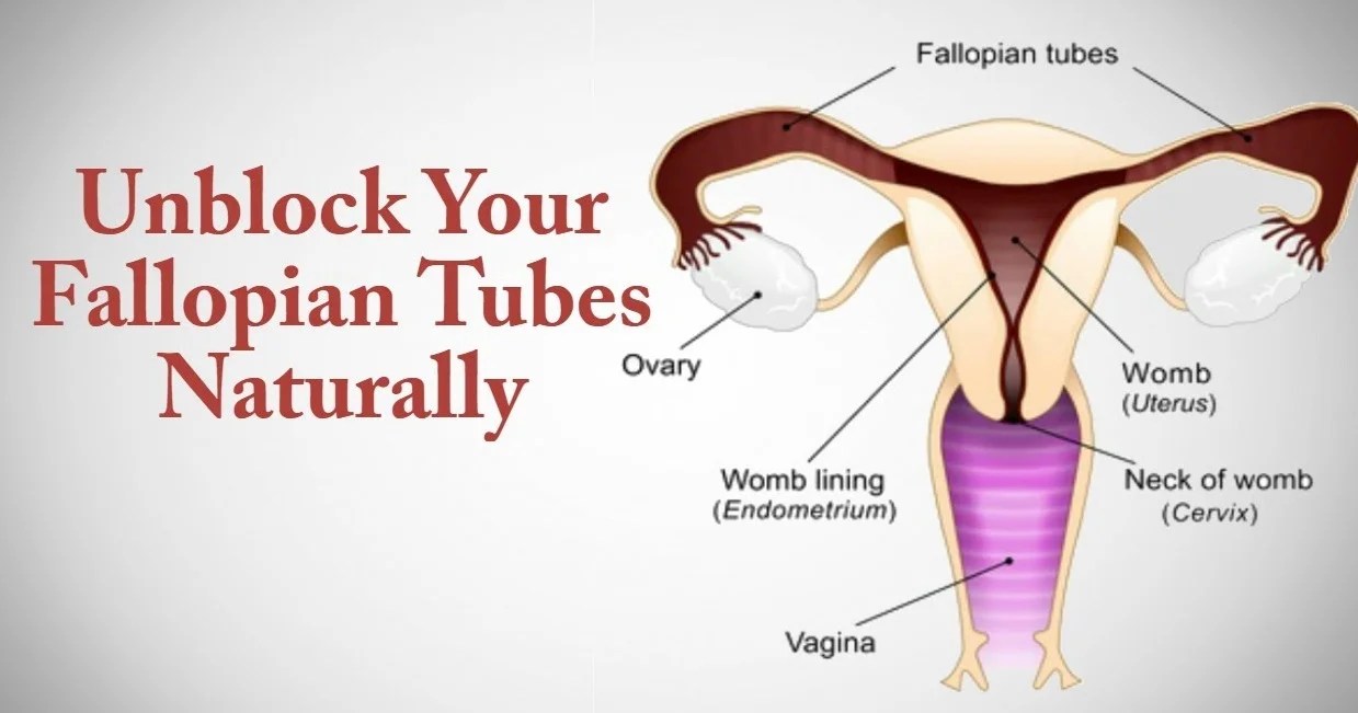 How to Get Rid of Blocked Fallopian Tubes