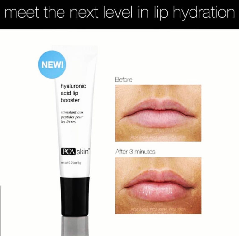 Beautiful, moist , plump lips! Beleza Salon Roswell