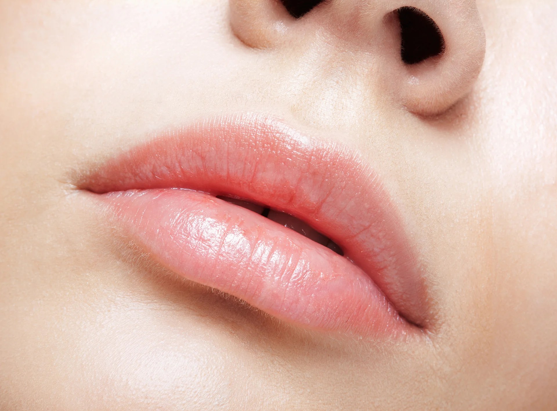 How to Reduce Swelling After Lip Filler