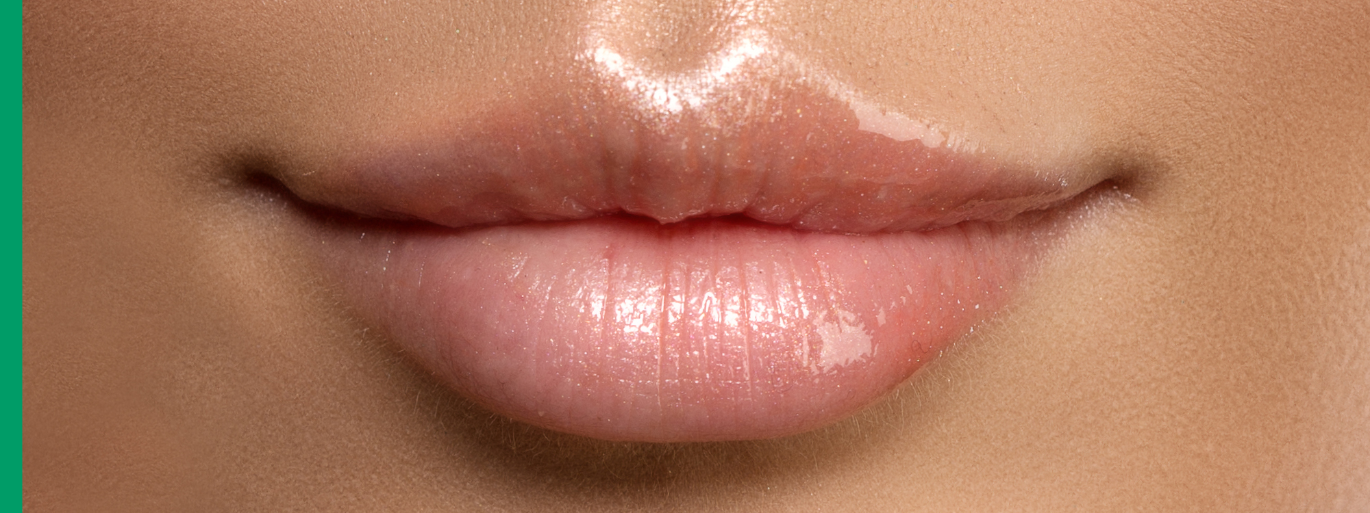 How Long Do Lip Fillers Last? Bella Vida Aesthetics Miami