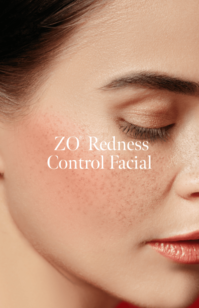 Which ZO Facial Treatment Suits Your Skin Concerns?